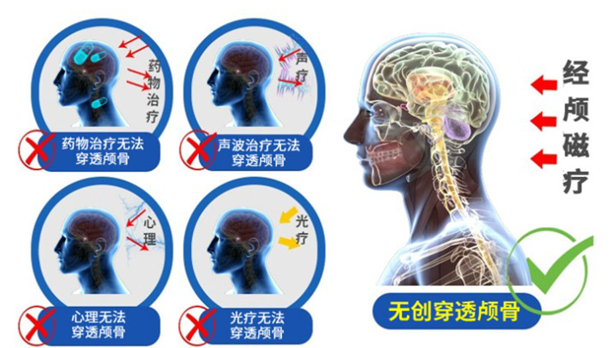 抑康家用治疗仪